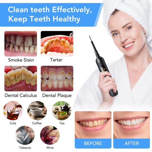 Electric Sonic Scaler Dental Cleaner